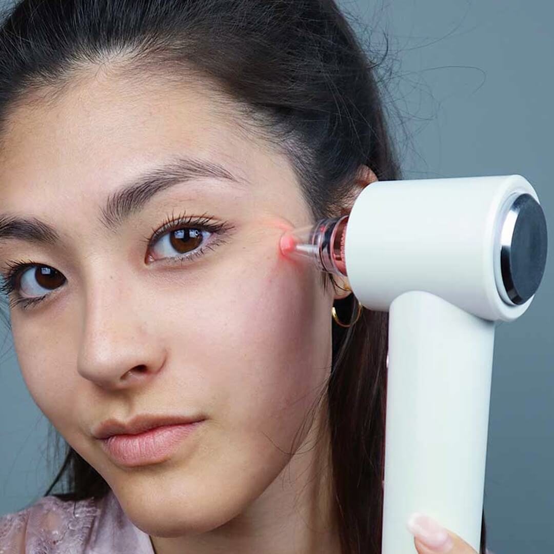 Clara Microdermabrasion Device